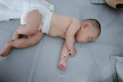 醴陵宝宝头上长痱子